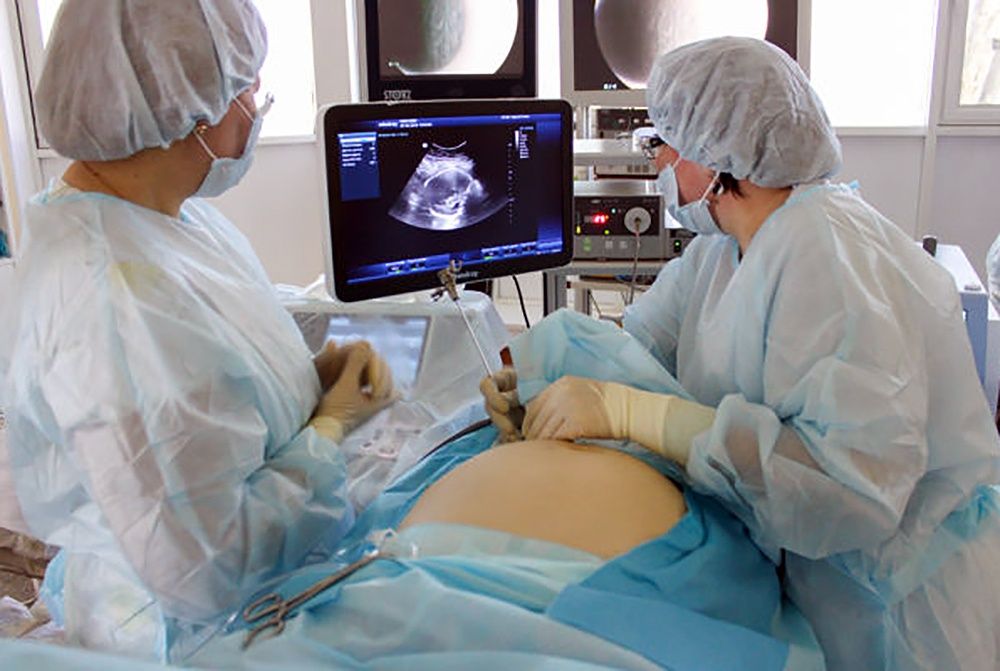 Российские хирурги впервые провели операцию на головном мозге еще не родившемуся ребенку